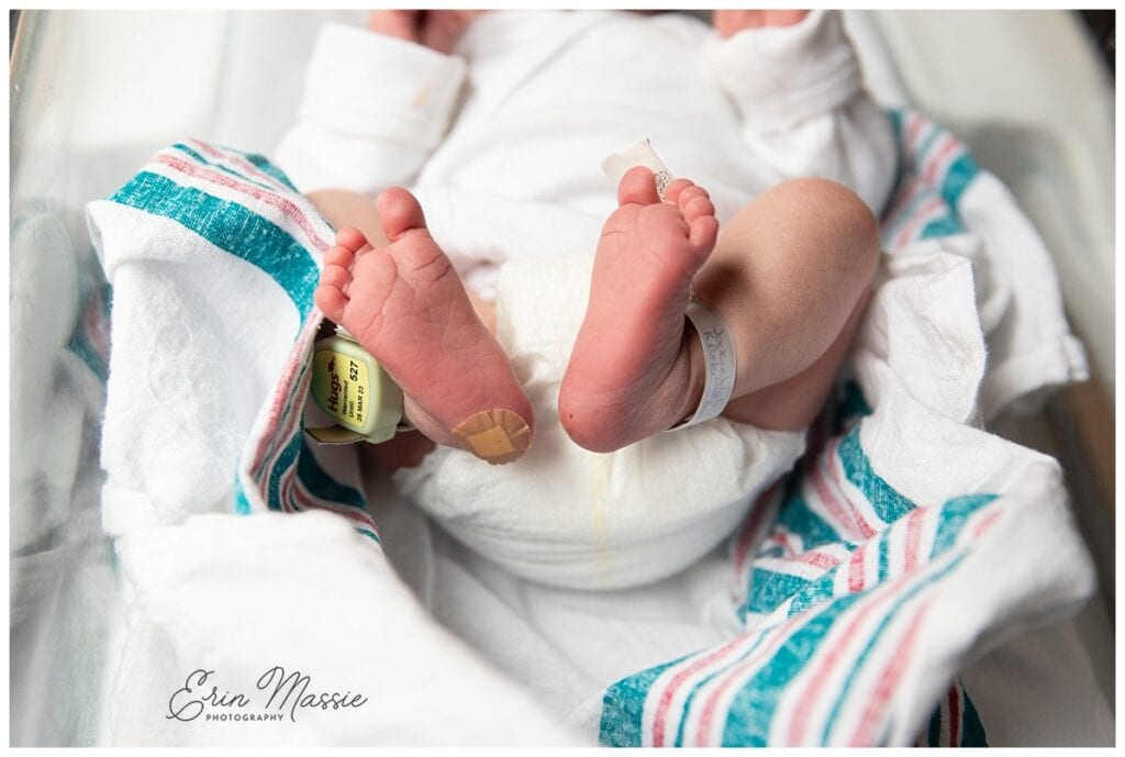 newborn baby feet with hospital bracelets during fresh 48 photo session