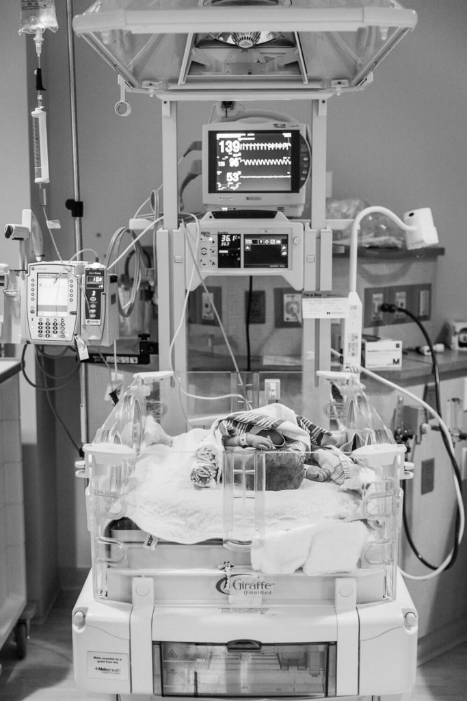 black and white newborn baby laying in hospital isolette surrounded by monitors